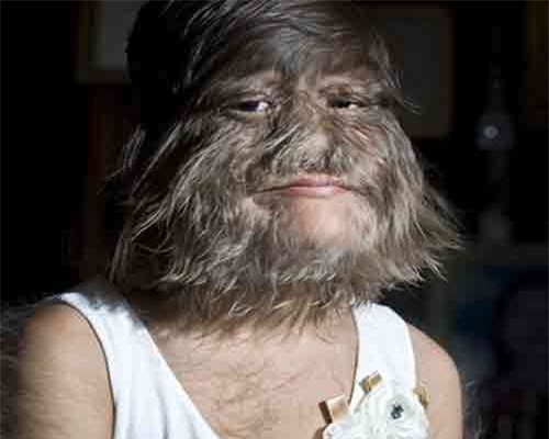 Sự thực khó tin về “người sói” có thật trong lịch sử