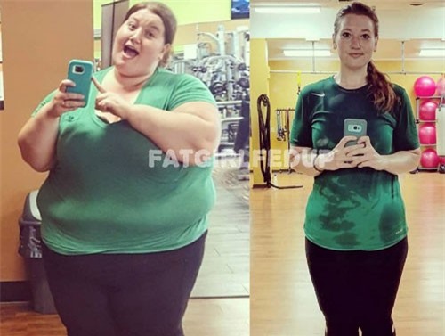 Giảm 141 kg thành công, 9X tiếp tục 'cuộc chiến' cắt bỏ 3 kg da chảy xệ