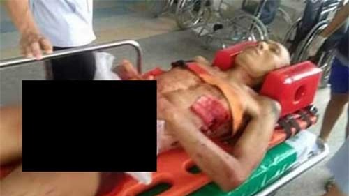 Dùng dao rọc giấy tự cắt “của quý” sau khi bị nhiều cô gái từ chối