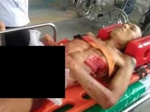 Dùng dao rọc giấy tự cắt “của quý” sau khi bị nhiều cô gái từ chối