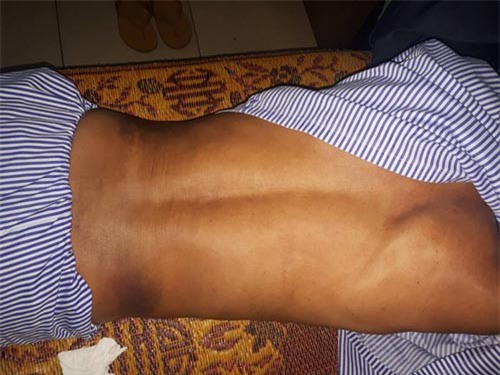 Ngăn trâu bò thả rông, trưởng thôn bị đánh nhập viện