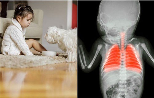 8 sản phẩm nguy hiểm cho trẻ nhỏ bố mẹ nên suy nghĩ 2 lần trước khi mua