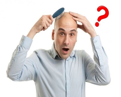 7 'độc chiêu' chữa hói đầu bất ngờ trên thế giới