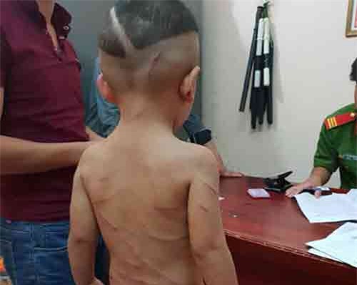 Phú Quốc: Bạo hành con riêng của vợ lãnh 3 năm 6 tháng tù giam