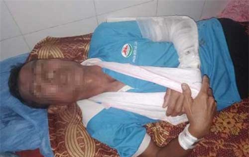 Hà Tĩnh: Vừa ra tù lại tiếp tục tìm nạn nhân đánh gãy tay