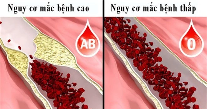 8 điều người nhóm máu O nên biết-6