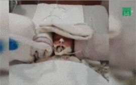 Clip: Mẹ lười đánh răng sữa, bé trai suýt tử vong