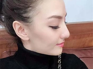 Hồng Quế phẫu thuật nâng mũi để 'thay đổi vận mệnh'