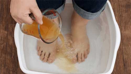 Những lợi ích khi ngâm chân trong giấm
