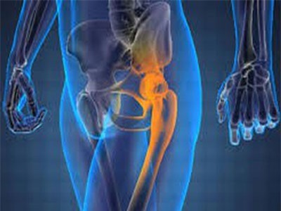 Bệnh nhân bất ngờ phát hiện ung thư xương khi đi khám 