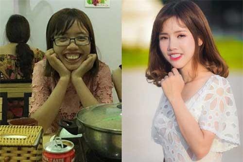 Những cô gái từng bị chê “xấu như thị nở” lột xác ngoạn mục gây sốt cộng đồng