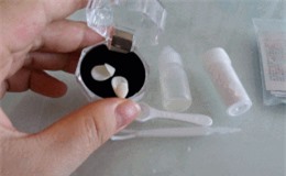 Clip: Hiểm họa khôn lường bởi trào lưu làm đẹp từ răng giả mua... trên mạng