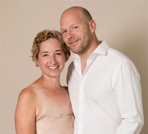 Bà mẹ 3 con đã dũng cảm khoe ra bộ ngực trần với vết sẹo, nhưng lý do đằng sau mới là điều đáng nể