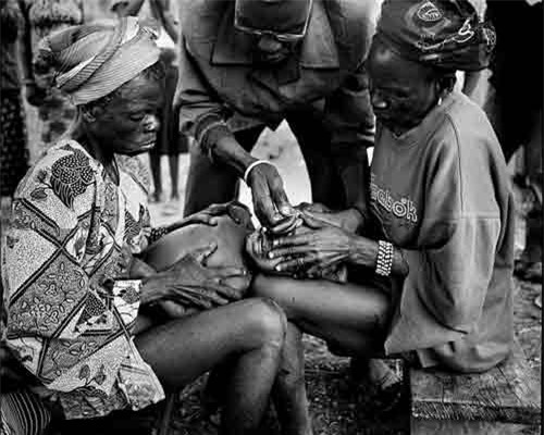 Hủ tục 'rạch mặt' trẻ em để đánh dấu tuổi trưởng thành