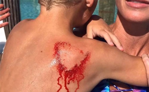 Du khách nhí bị loài cá mập nổi tiếng “hiền lành” tấn công bất ngờ