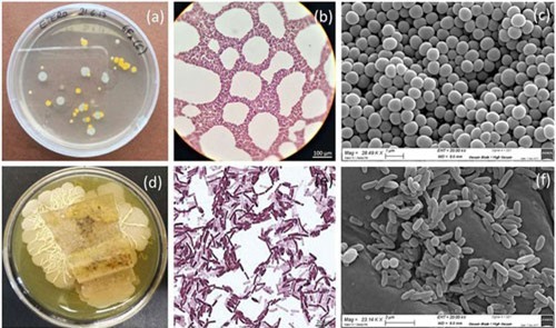 Vi khuẩn bảo vệ tranh cổ khỏi các vi khuẩn ăn sắc tố