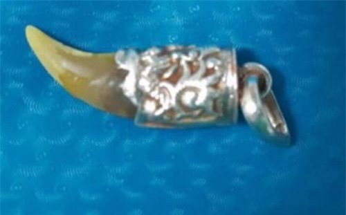 Quảng Bình: Lấy thành công nanh hổ trong tá tràng bé 23 tháng tuổi