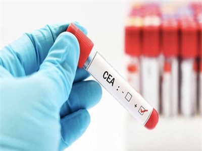 Ưu nhược điểm của các tầm soát ung thư