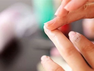 Ứng dụng điện thoại chẩn đoán được bệnh thiếu máu qua ảnh