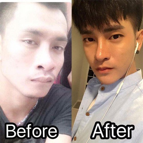 Chàng trai Thái bỏ hàng trăm triệu làm phẫu thuật thẩm mỹ để giống sao Hàn