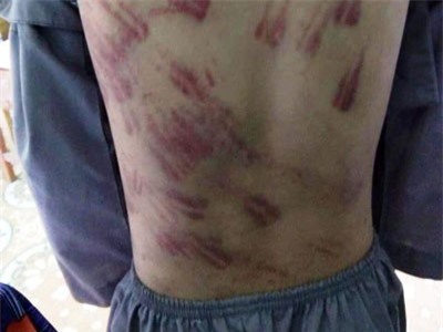 Cháu bé mồ côi không dám kể chuyện bị sư thầy bạo hành vì sợ bị... đánh chết