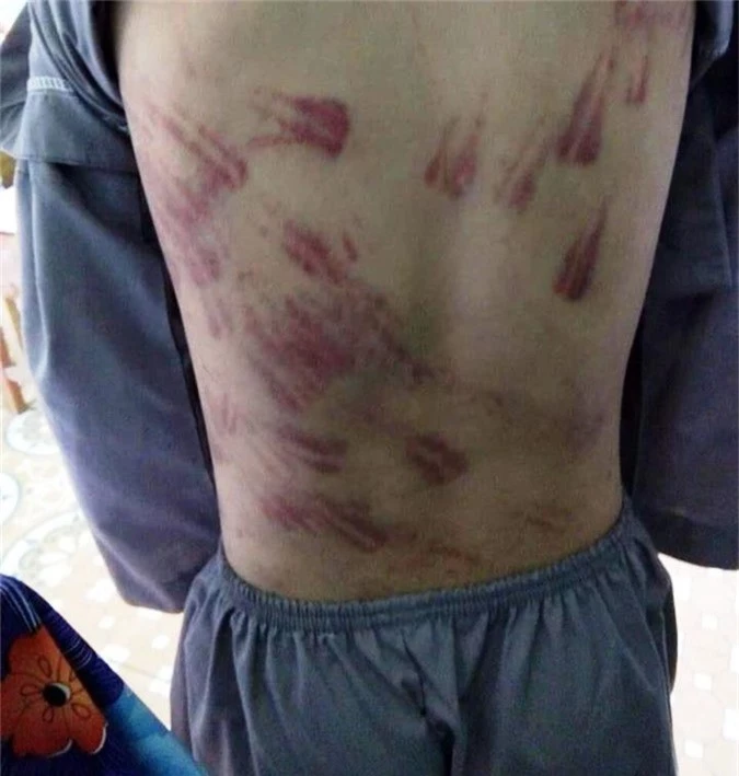 Cháu bé mồ côi không dám kể chuyện bị sư thầy bạo hành vì sợ bị... đánh chết! - Ảnh 1. Cháu bé mồ côi không dám kể chuyện bị sư thầy bạo hành vì sợ bị... đánh chết! - Ảnh 1.
