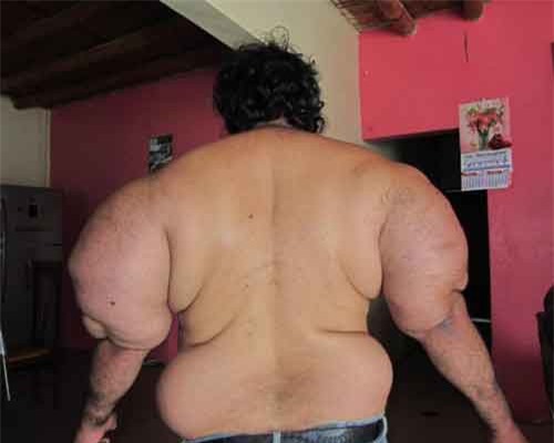 Người đàn ông mang hình dáng như thủy thủ Popeye và câu chuyện kinh hoàng phía sau