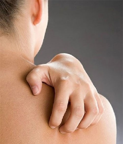 Vì sao sau khi tắm vào mùa đông hay bị ngứa?