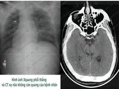 Quên ăn sáng, tài xế hôn mê sâu khi lái xe