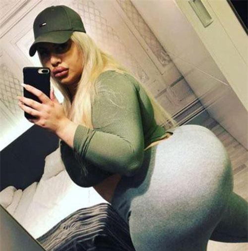 4 năm 3 lần phẫu thuật, cô gái nuôi ước vọng có vòng 3 to nhất thế giới