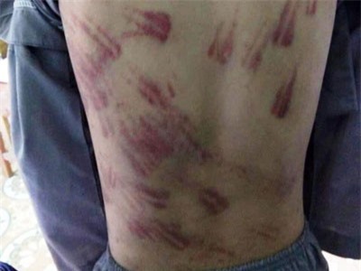 Cháu bé bị sư thầy bạo hành nói gì tại cơ quan công an?