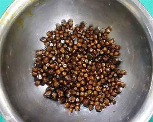 Người phụ nữ 60 tuổi mang 400 viên sỏi trong túi mật