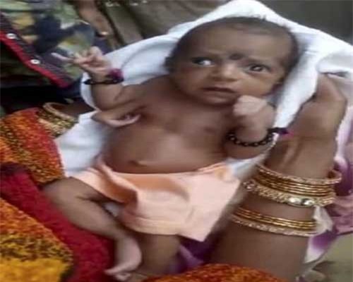 Bé gái Ấn Độ chào đời với 3 bàn tay được người dân tôn thờ như một vị thần