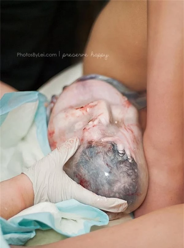 20 bức ảnh thể hiện vẻ đẹp trần trụi của quá trình sinh nở - Ảnh 18.