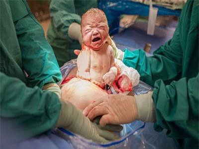 20 bức ảnh thể hiện vẻ đẹp trần trụi của quá trình sinh nở