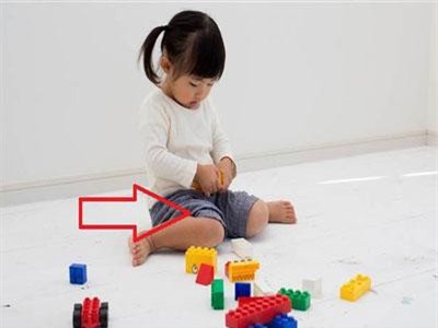 Hậu quả khôn lường từ tư thế ngồi vô cùng phổ biến ở trẻ nhỏ