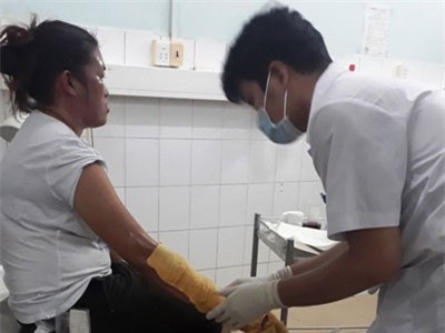 Nổ bình gas mini ở chợ đêm Phú Quốc, nhiều du khách bị bỏng