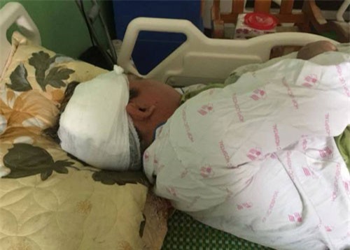 Thanh Hóa: Nhóm côn đồ bịt mặt xông vào nhà dân hành hung người