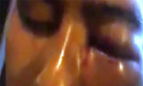 Đồng Nai: Cán bộ ngân hàng bị tố đánh trọng thương nguyên chiến sĩ công an