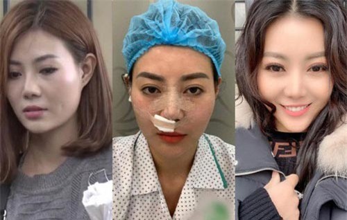 Nối gót Quỳnh búp bê, Thanh Hương chạy theo mốt mặt dài cằm nhọn, 'lột xác' thành người khác