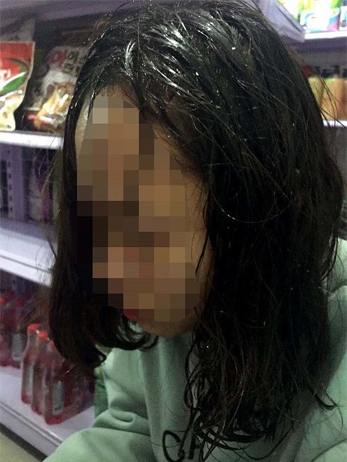 Hà Nội: Nữ nhân viên C-Mart bị băng nhóm đòi nợ thuê đánh chảy máu đầu