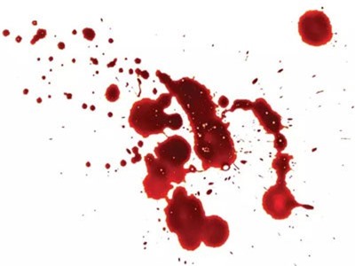 Tại sao mất máu có thể làm bạn ngất xỉu?