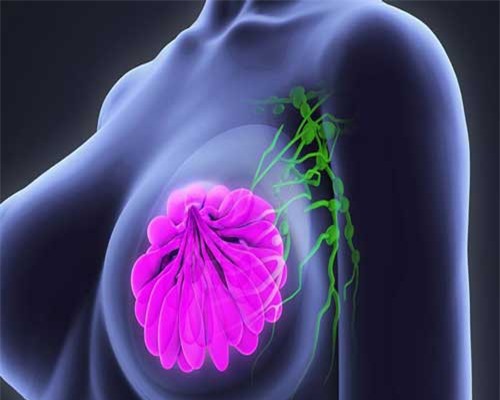 Phương pháp mới biến tế bào ung thư vú thành mỡ