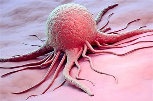 6 nguyên tắc vàng phòng tránh ung thư đơn giản, cần ghi nhớ để cả đời không còn phải sợ tử thần ghé thăm