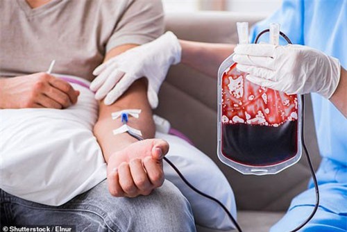 Bệnh Alzheimer có liên quan đến truyền máu?