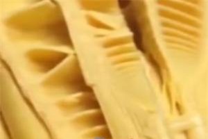 CLIP: 5 căn bệnh tuyệt đối không được ăn măng