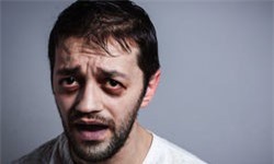 Nhận biết thiếu vitamin qua khuôn mặt