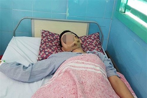 Đau quặn vùng hông sau ngã vài tiếng, bác sĩ xác định do vỡ thận