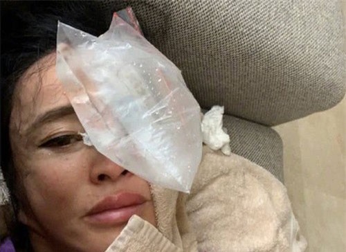 Lưu Hiểu Khánh gặp tai nạn nghiêm trọng nhưng câu nói ngay sau khi tỉnh dậy lại khiến nhiều người ngạc nhiên