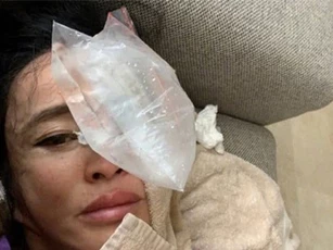 Lưu Hiểu Khánh gặp tai nạn nghiêm trọng nhưng câu nói ngay sau khi tỉnh dậy lại khiến nhiều người ngạc nhiên